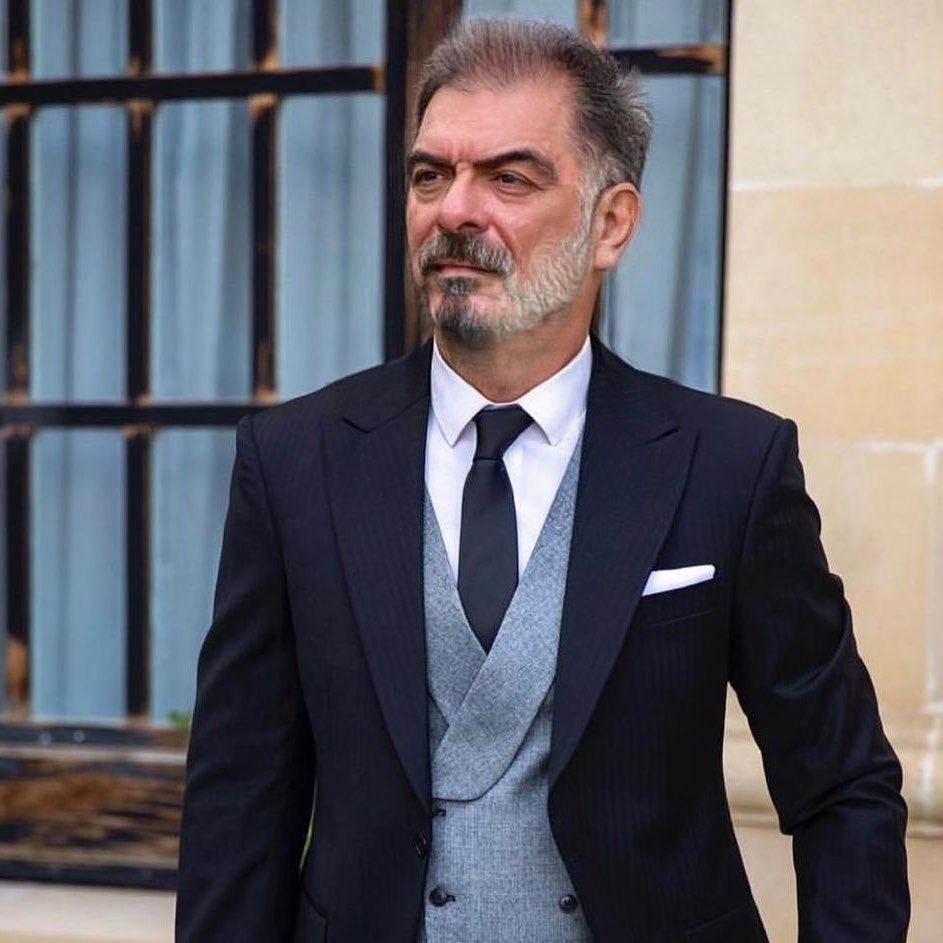 Şou-biznesdə yeni trend: özlərini qocaltdılar - FOTO